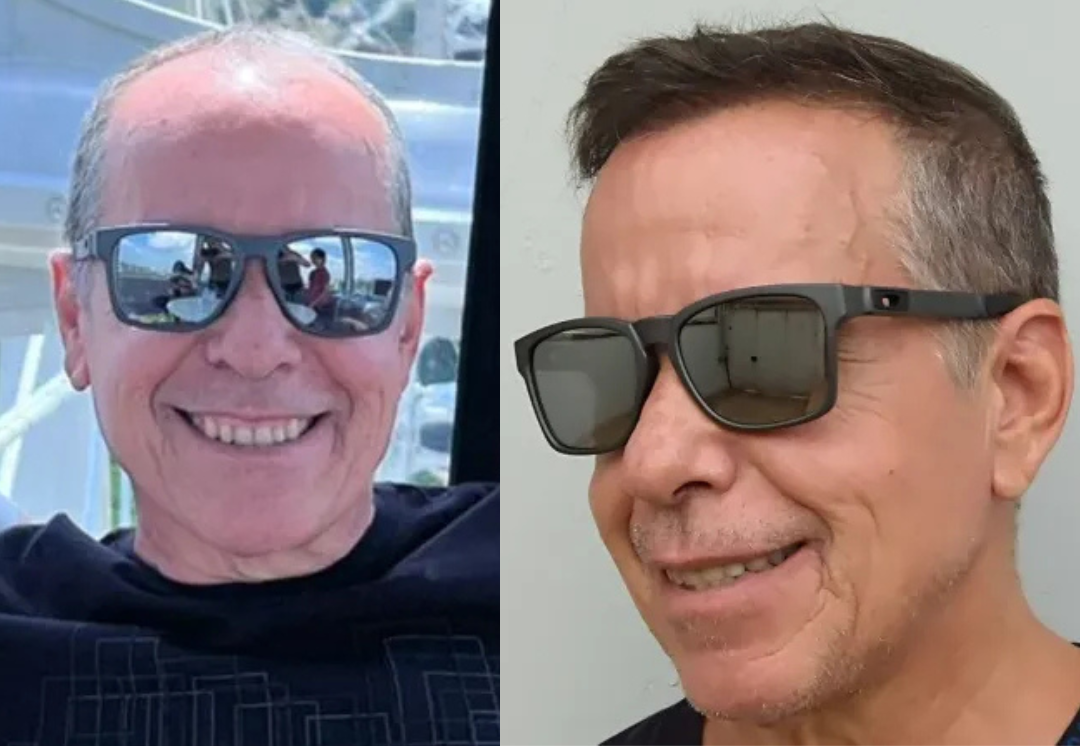 Antes e Depois de Antônio Silva