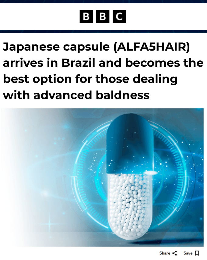 Print de matéria internacional sobre a tecnologia japonesa de calvície